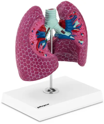 Maquette anatomique du système respiratoire - Avec poumon malade